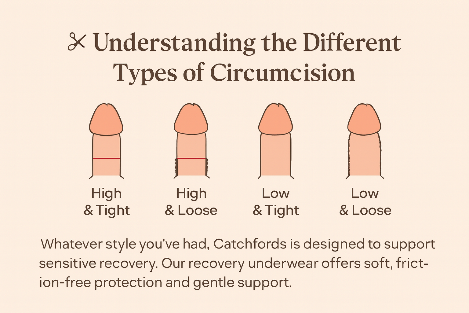Mieux comprendre les diverses formes de circoncision